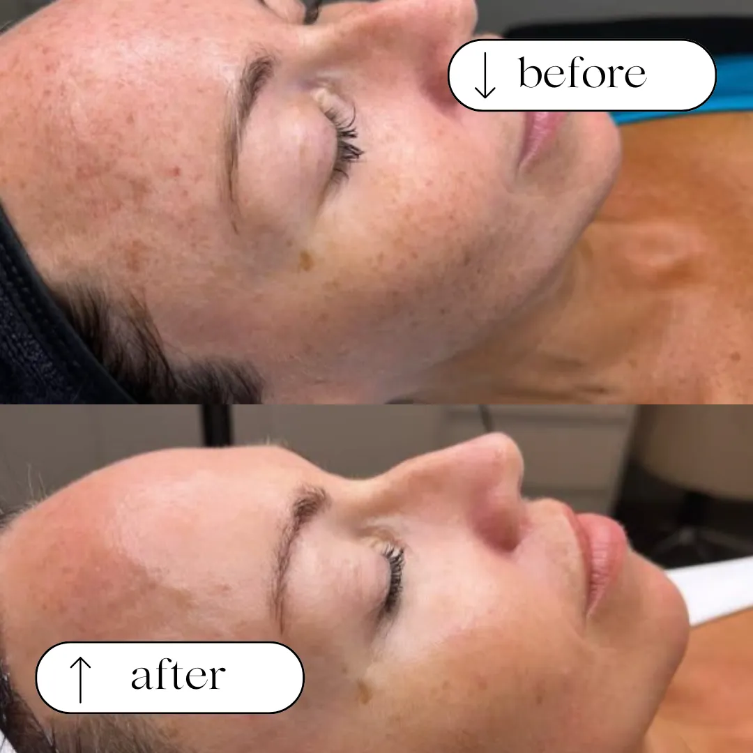 Visibly clearer, smoother skin