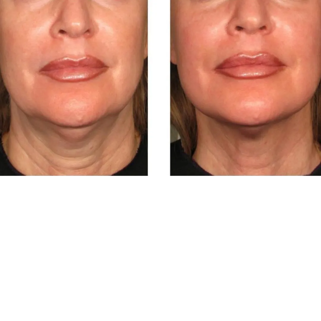 Firmer, lit-from-within glow