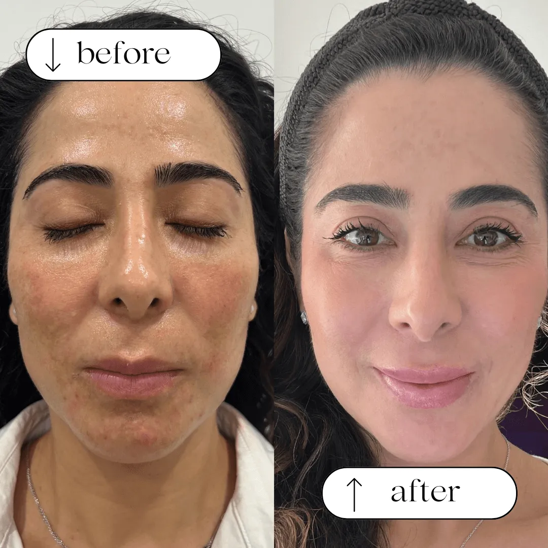 Significantly reduced dark spots
