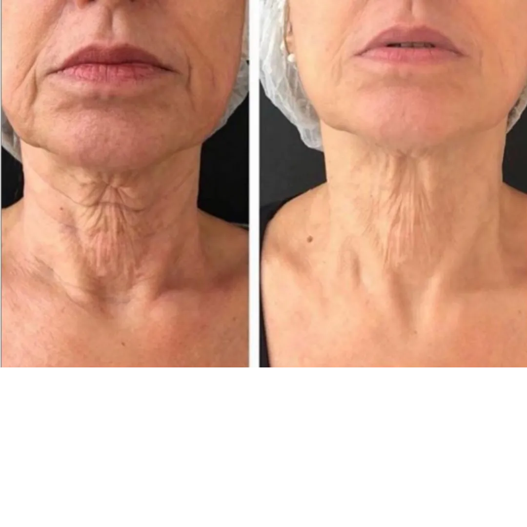 Firmer, lit-from-within glow